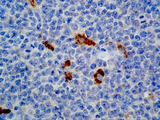 IHC of Alpha-1-Antichymotrypsin on a FFPE Tonsil Tissue
